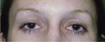 Patient Example.