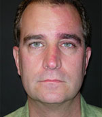 Patient Example.