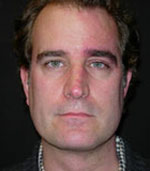 Patient Example.