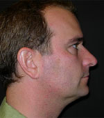 Patient Example.