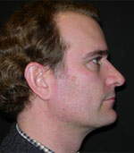 Patient Example.