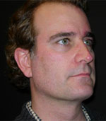 Patient Example.