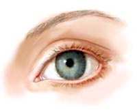 After Canthoplasty