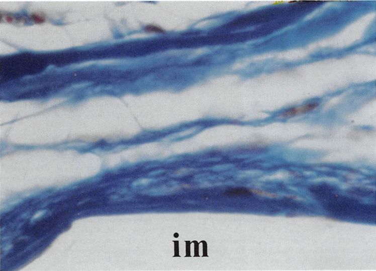 Fig. 5. Loose connective tissue forming a capsule around a smooth surfaced polyethylene implant. The implant is at the bottom of the slide (ini). Original magnification, 400X; trichrome stain.