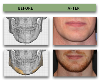 bespoke-plastic-surgery-03