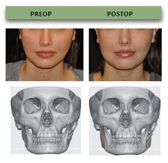 bespoke-plastic-surgery-05