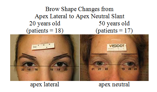 brow