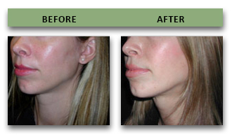 Penis Enlargement Options Available in Essex