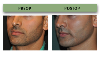 Rhino 8 Gummy Male Enhancement Supplement 24 Bags per Box (2 Servings Per Bag)